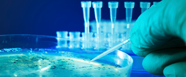 measuring bacterial growth on a petri dish